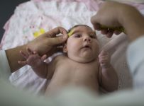 Confirman nacimiento de otro bebé con microcefalia debido al zika