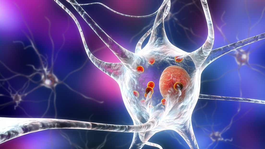 Identifican qué células cerebrales mueren a causa de la enfermedad de Parkinson