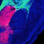 Científicos descubren la molécula que da origen al miedo en el cerebro