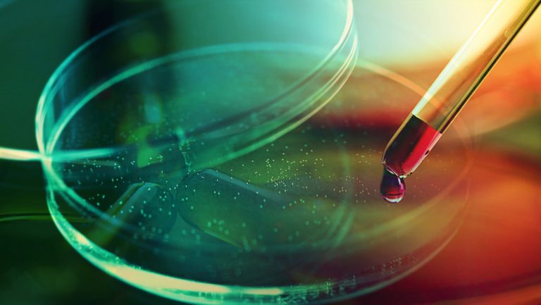 Confirman la primera coinfección por VIH, viruela del mono y covid-19