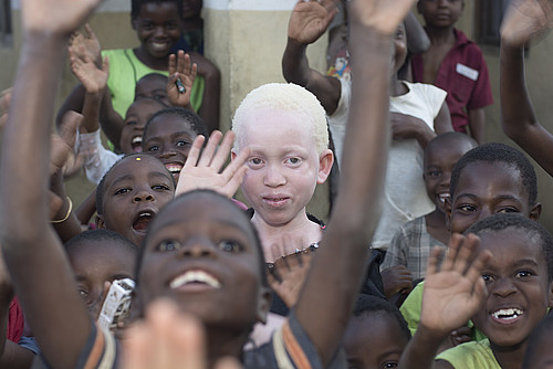 La Policía de Madagascar mata a 19 personas que buscaban vengar el secuestro de un niño albino