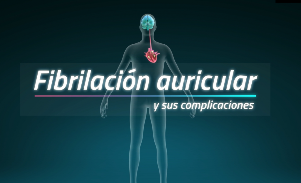 Presentan una nueva opción de tratamiento anticoagulante para la prevención del infarto cerebral