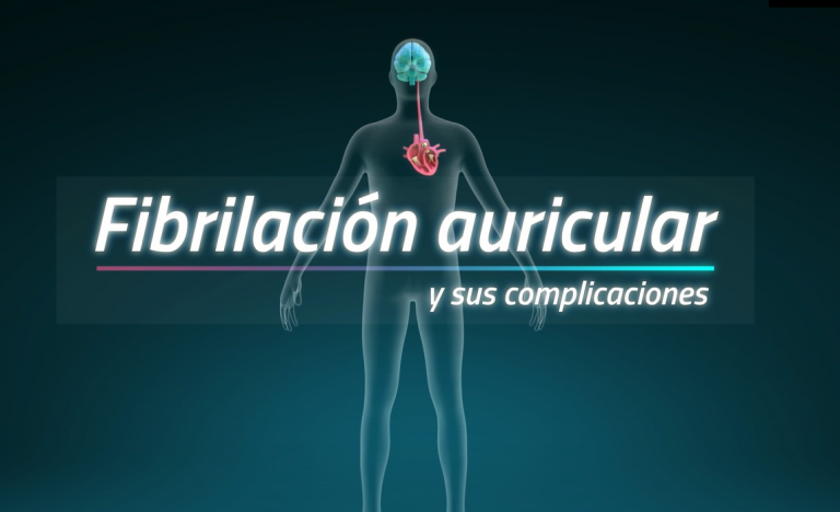 Presentan una nueva opción de tratamiento anticoagulante para la prevención del infarto cerebral