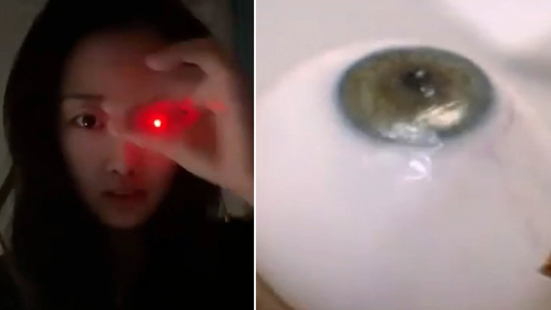 Mujer que perdió un ojo desarrolla una prótesis brillante 'a lo Terminator' Mujer que perdió un ojo desarrolla una prótesis brillante 'a lo Terminator'