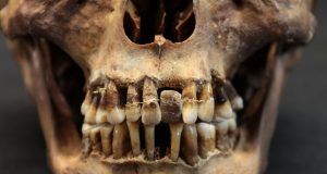 Este estudio completa la historia de la odontología