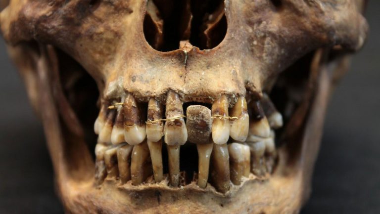 Este estudio completa la historia de la odontología
