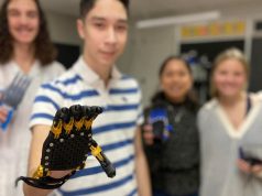 Proyecto de prótesis robótica para estudiante con malformación congénita en mano
