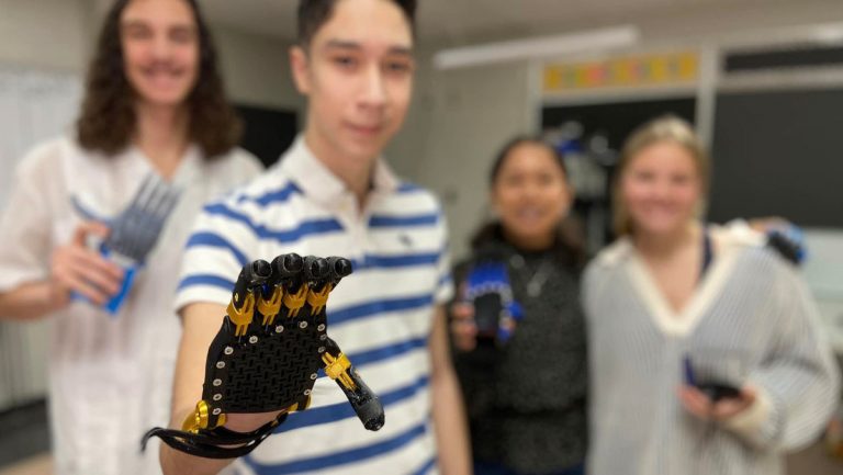 Proyecto de prótesis robótica para estudiante con malformación congénita en mano
