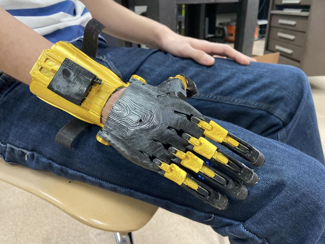 Proyecto de prótesis robótica para estudiante con malformación congénita en mano