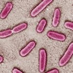 Gotas oculares contaminadas causan pérdida de visión y varias muertes en EE.UU.