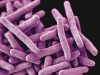 Muertes por tuberculosis aumentan en la región europea tras décadas del descenso más rápido del mundo