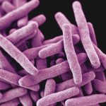 Muertes por tuberculosis aumentan en la región europea tras décadas del descenso más rápido del mundo