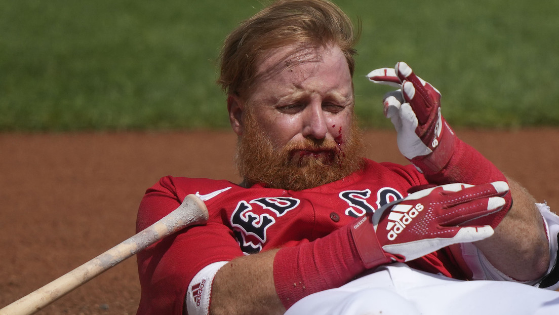 Un fuerte pelotazo en el rostro manda a un beisbolista de los Boston Red Sox al hospital