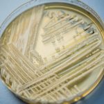 Una infección fúngica mortal se propaga a un ritmo "alarmante" en los hospitales de EE.UU.