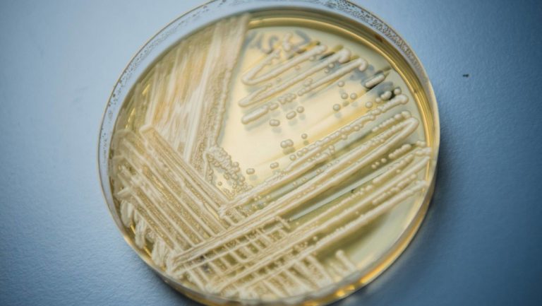 Una infección fúngica mortal se propaga a un ritmo "alarmante" en los hospitales de EE.UU.