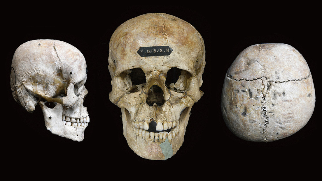 ¿Por qué en este antiguo pueblo japonés deformaban los cráneos de sus habitantes?
