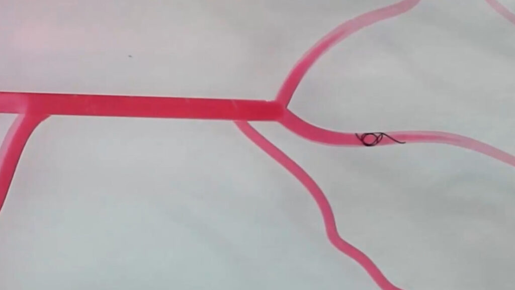 Crean un diminuto robot que podría ayudar a tratar aneurismas y tumores cerebrales