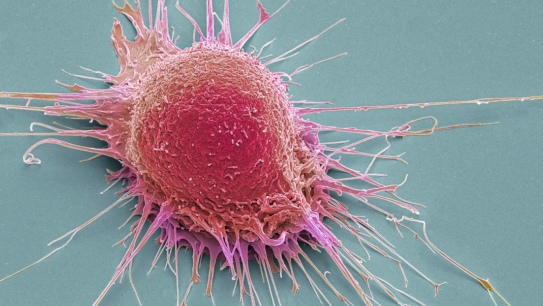 La IA revela que el cáncer de próstata se divide en dos subtipos diferentes