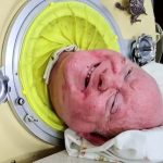 Muere un hombre que vivió más de 70 años en un pulmón de acero