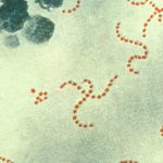 Japón registra cifras récords de infección por un estreptococo 'carnívoro' letal